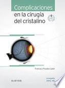 Libro Complicaciones en la cirugía del cristalino