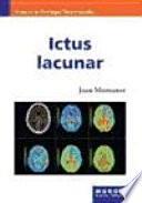 Libro Ictus lacunar