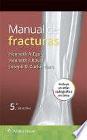 Libro Manual de fracturas