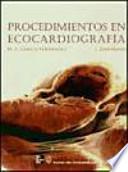 Libro Procedimientos en ecocardiografía