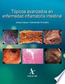 Libro Tópicos avanzados en enfermedad inflamatoria intestinal